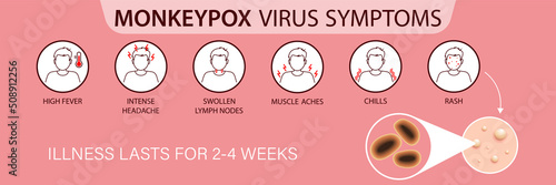 Symptoms of the monkey pox virus.  Monkey pox is spreading. This causes skin infections. Infographic of symptoms of the monkey pox virus photo