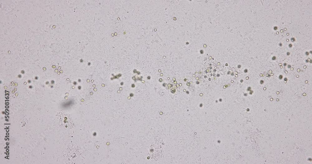 Bacteria and Protozoa in waste water under the microscope. Bacteria and Protozoa in waste water under the microscope.