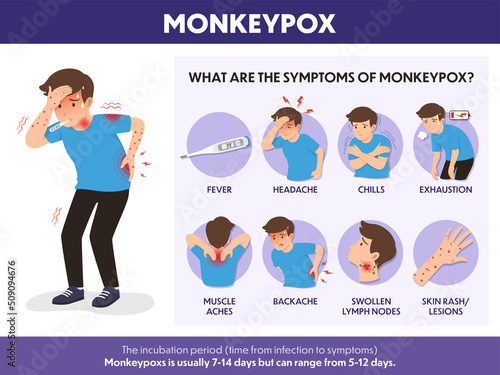 Infographic of Monkeypox Symptoms. photo