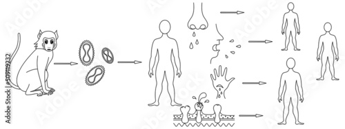 Monkeypox. Scheme of infection and methods of transmission to humans of the smallpox virus. Sketch. Monkey - virus - man. Vector illustration. Coloring book for children. Viral disease. 