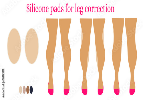 Silicone pads for the correction of women's crooked legs. Examples of improved leg shape. Advertising for women. Poster. Flat digital vector illustration

