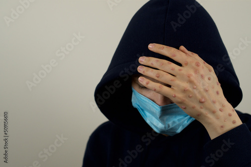 Sick woman hiding her face with hand 