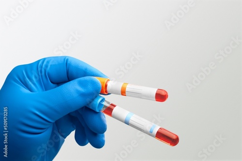 Doctor holding Blood sample tube for analysis test in the laboratory. Blood tube test and requisition form for analysis photo