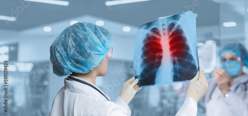 Εκτύπωση καμβά A doctor on an x-ray examines the lungs .