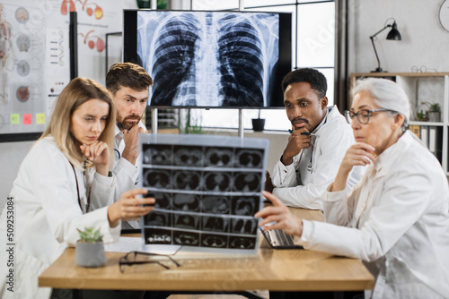 Pensive multiracial doctors examining patients CT scan of chest and abdominal cavity while sitting around desk. Pulmonology  lung pathology and tuberculosis diagnostics concept.