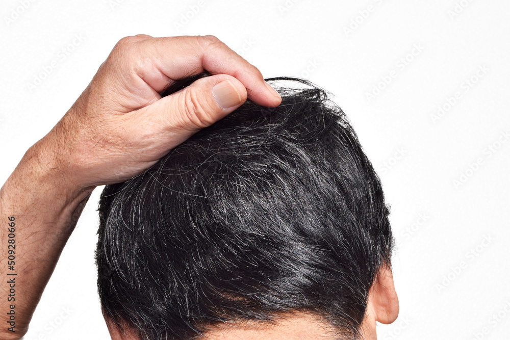 Fototapeta premium 頭頂部を押さえる年配の男性