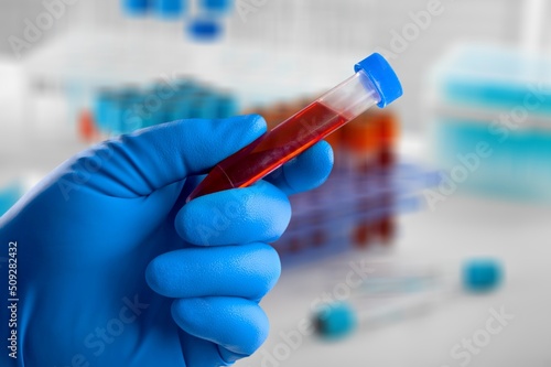 Blood sample of patient for test in laboratory. Doctor with Blood tube test in lab