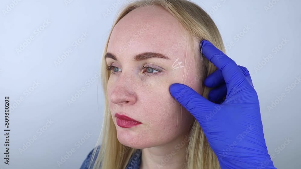 Fox eye lift. Before and after. On left is a girl with normal eyes, and