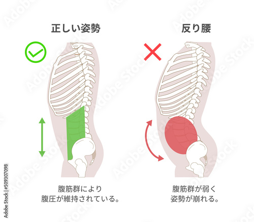 腹筋群と腹圧と姿勢の関係図説イラスト　横向き横向き