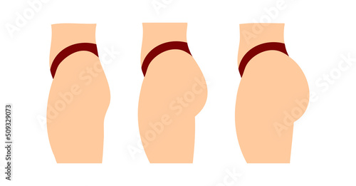 Concept of an increase in the buttocks. Vector concept illustration isolated on white background, side view profile. Flat women butt set in bikini.