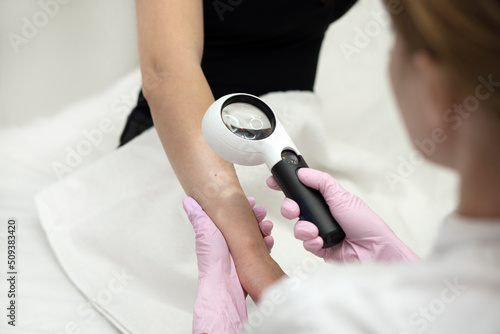 Close-up of a dermatologist examining a mole on the hand of a female patient using a magnifying glass in the clinic photo