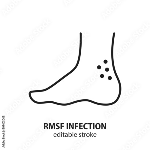 Rocky mountain spotted fever line icon. Symptom of tick-borne rickettsiosis symbol. Rash on ankle vector sign. Editable stroke.