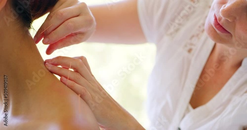 caucasian acupuncturist treating mixed race patient in clinic. Focused therapist inserting acupuncture needles in hispanic client neck. Releasing neck muscle tension with holistic treatment