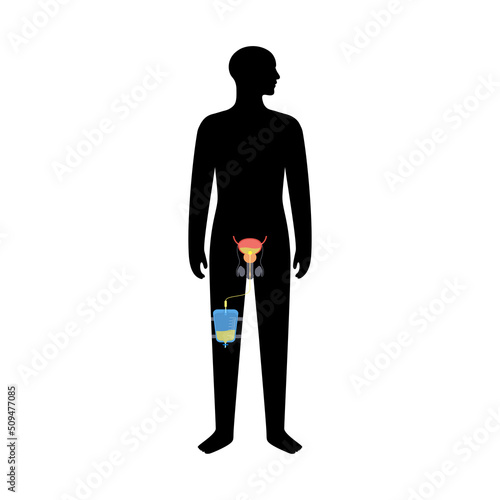 Urinary drainage bag