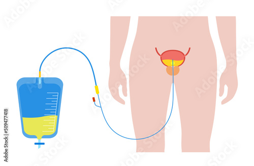 Urinary drainage bag