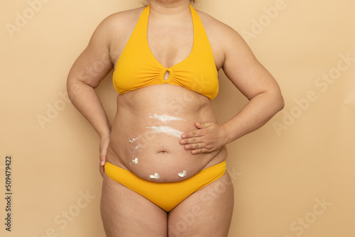 Fat woman in yellow swimsuit apply spot white body cream on thick sagging stomach, beige background. Slimming, fighting overweight, obesity and cellulite. Plus size people and body positive concept.