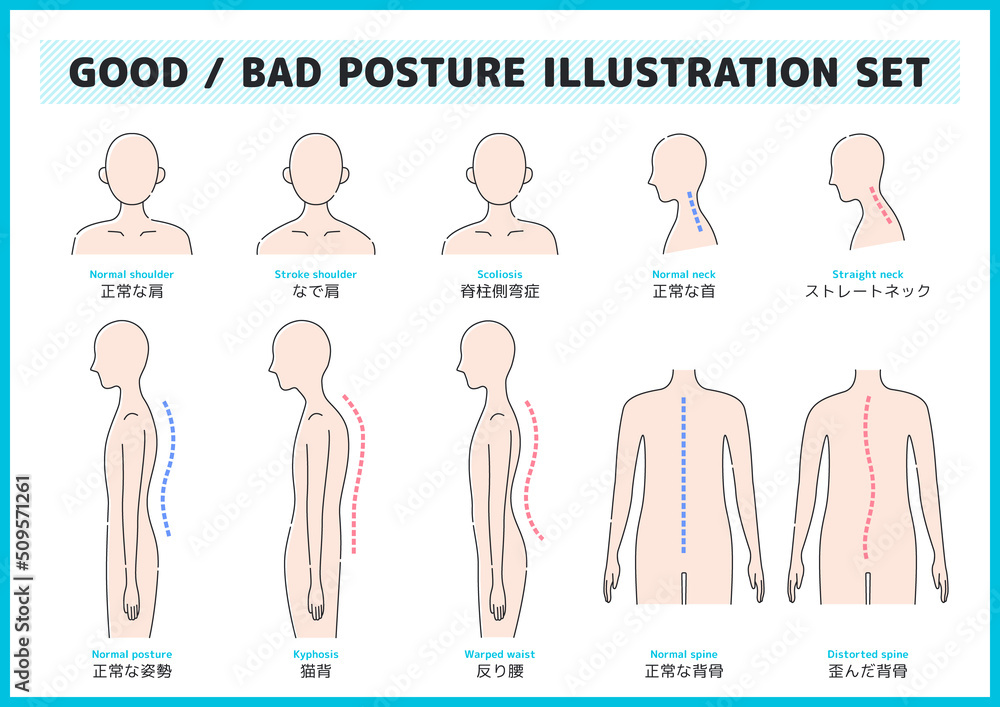 人間の身体 病気 症状 姿勢 イラスト アイコン 素材 セット Stock Vector Adobe Stock