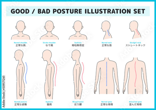 正しい姿勢や猫背などのイラスト素材セット