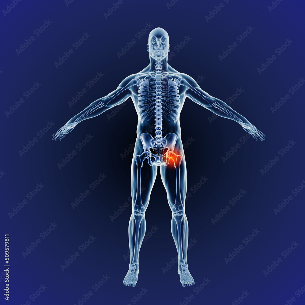 When inflammation strikes. Computer generated illustration of the human body indicating the skeletal structure When inflammation strikes. Computer generated illustration of the human body indicating the skeletal structure