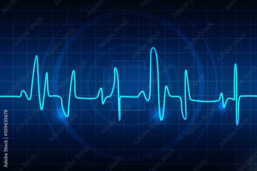 Cardiogram concept -2D rendering illustration