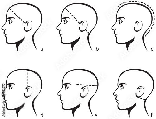 Stylized image of a male head. Template for selecting the size of a wig or hair system or caps for men. Measuring size chart. Vector illustration isolated on white background.