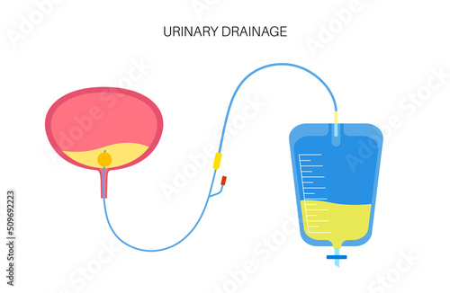 Urinary drainage bag