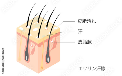 汚れた頭皮の断面図の図解イラスト、アイソメトリック