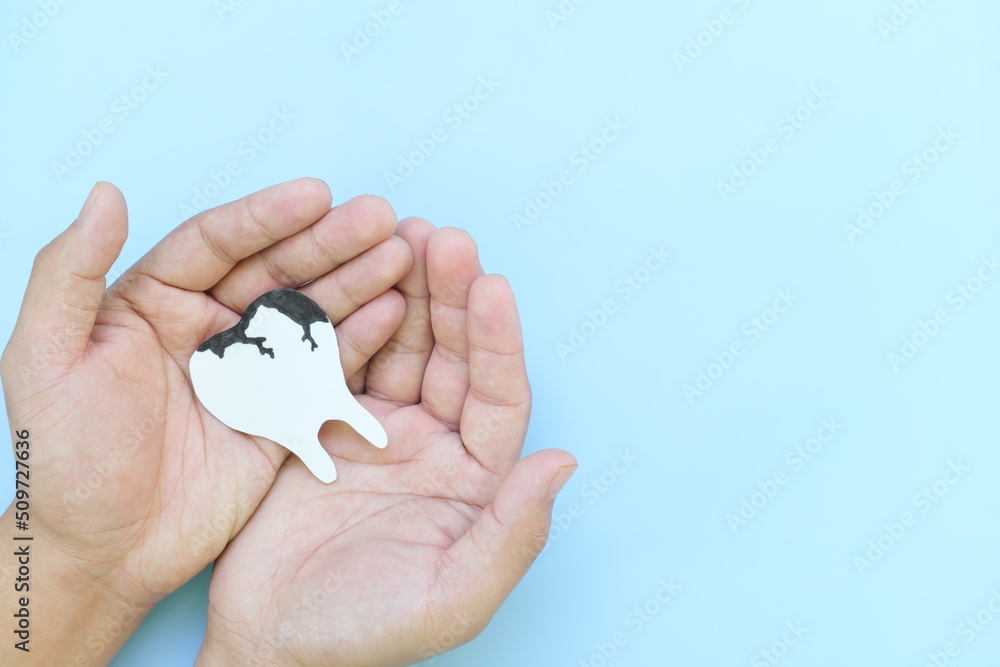 Tooth decay and dental cavities care concept. Top view of hands holding a big white tooth with black dental caries cutout in blue background with copy space. Tooth decay and dental cavities care concept. Top view of hands holding a big white tooth with black dental caries cutout in blue background with copy space.