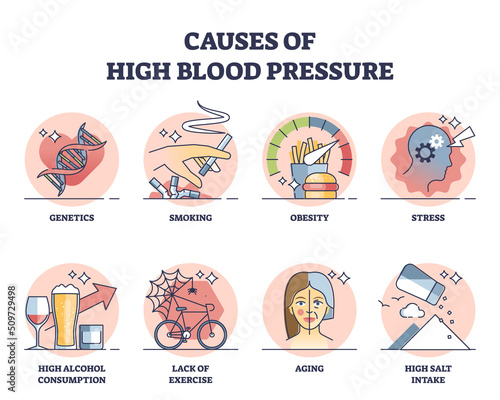 Causes of high blood pressure with cardiology risks outline collection set. Labeled educational scheme with unhealthy lifestyle factors that impact heart vector illustration. Medical disease triggers.
