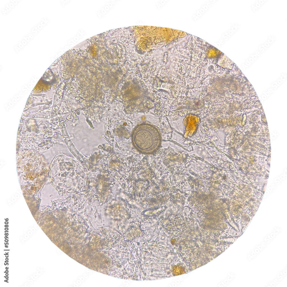 Egg of parasite in stool exam. Egg of parasite in stool exam.