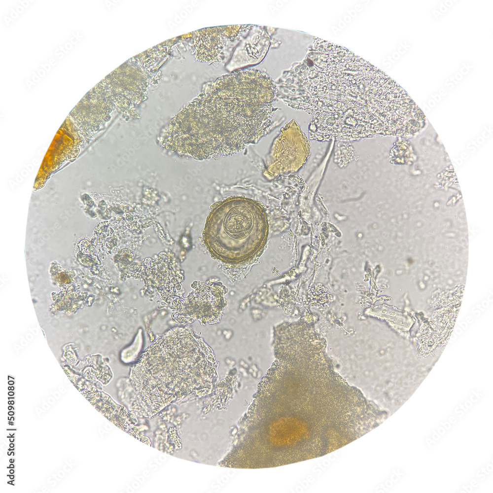 Egg of parasite in stool exam. Stock Photo | Adobe Stock