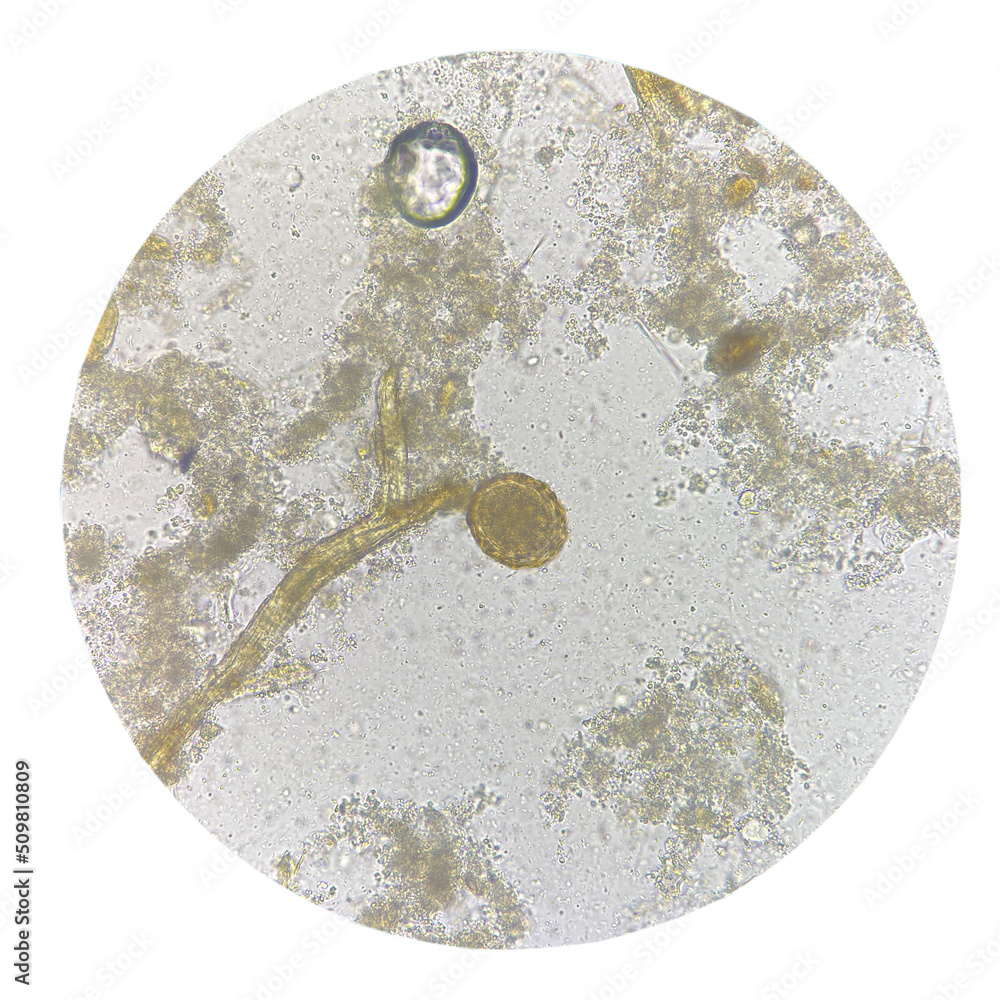 Egg of parasite in stool exam. Egg of parasite in stool exam.