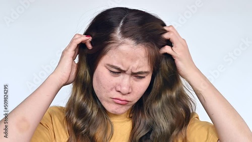 Asian woman scratching her scalp caused of itchy scalp. Dandruff and an inflammatory skin condition called seborrheic dermatitis are the most common causes of itchy scalp. photo