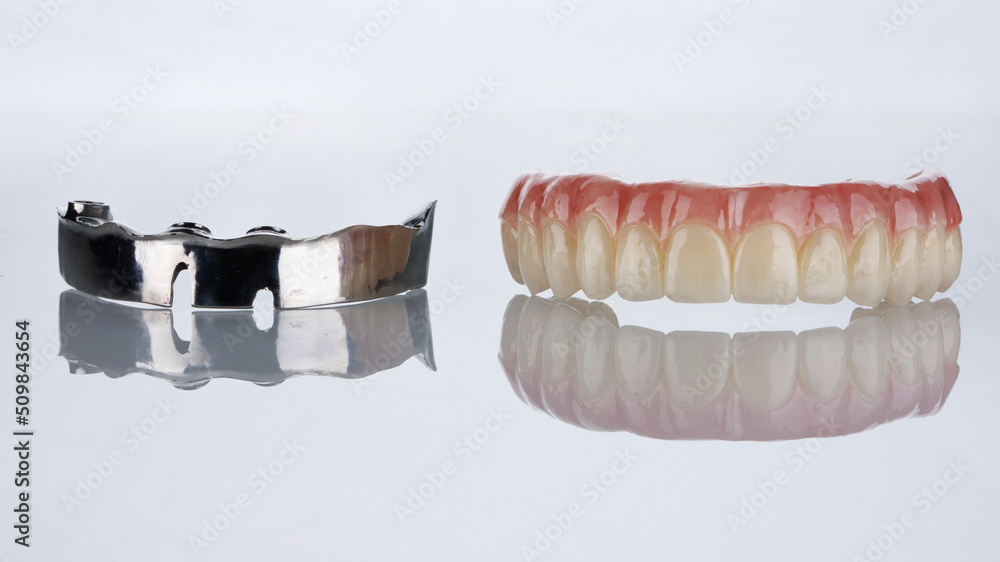 Titanium beam and zircon prosthesis on white glass with reflection Titanium beam and zircon prosthesis on white glass with reflection
