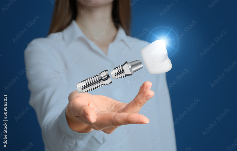 Woman demonstrating dental implant on blue background, closeup Woman demonstrating dental implant on blue background, closeup