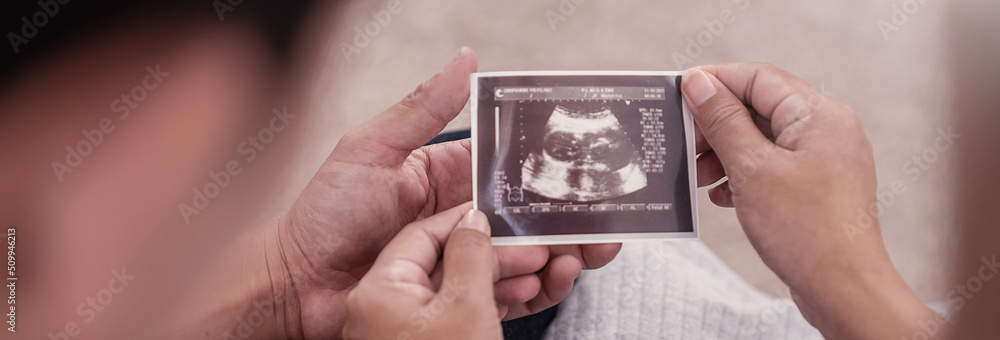 Asian or caucasian pregnant woman and husband holding ultrasound 4d scan image, Expectation of a child and Maternity prenatal care.Parenthood, bonding together, woman pregnancy concept banner - obrazy, fototapety, plakaty 