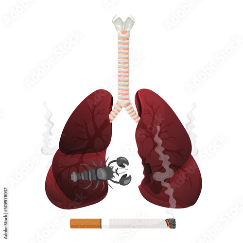 Illustration of lung smoker, lung cancer disease. The concept of stop smoking. Vector illustration.