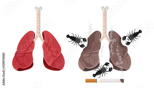 Illustration of lung smoker, lung cancer disease. The concept of stop smoking. Vector illustration.