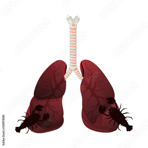 Illustration of lung smoker, lung cancer disease. The concept of stop smoking. Vector illustration.
