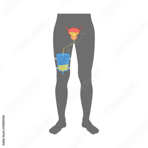 Urinary drainage bag