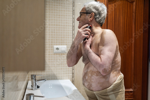 old man with vitiligo in the bathroom photo