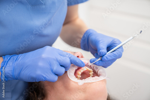 Dentist Hands Adjusting Ceramic Braces To Patient photo