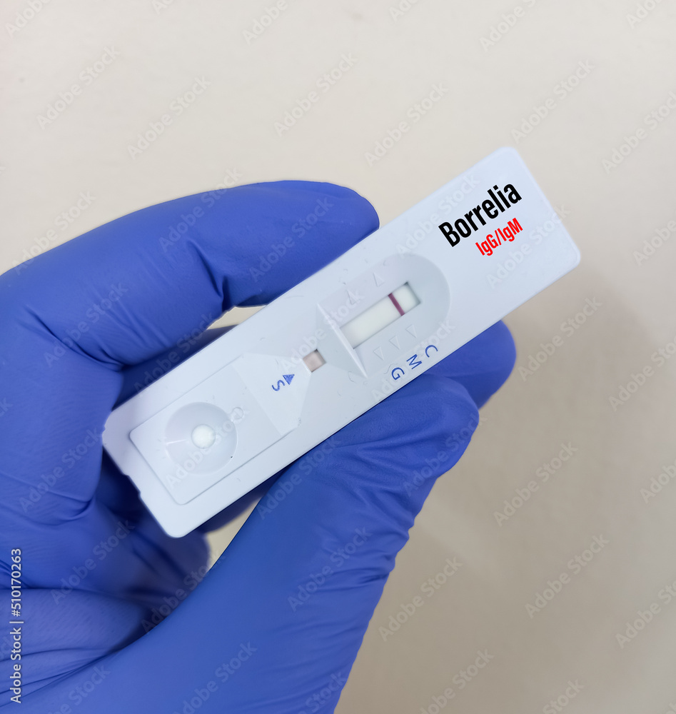 Rapid test kit or cassette for Borrelia IgG and IgM test, Lyme disease diagnosis.