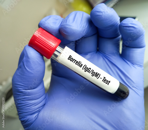 Blood sample tube for Borrelia IgG and IgM test, Lyme disease diagnosis. photo