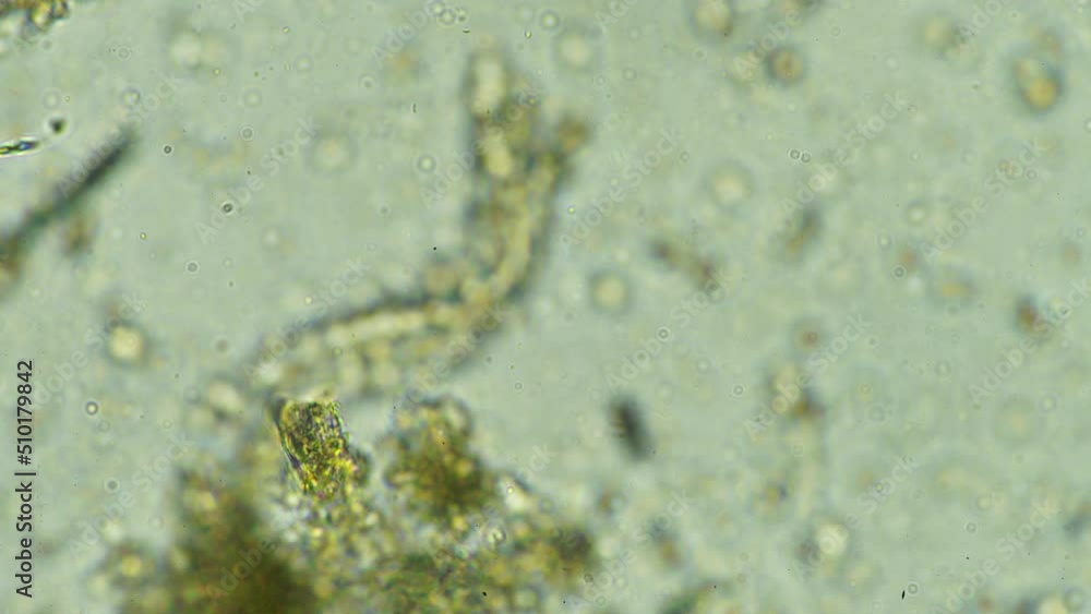 soil microbes in a soil sample on a sustainable agricultural farm in australia soil microbes in a soil sample on a sustainable agricultural farm in australia