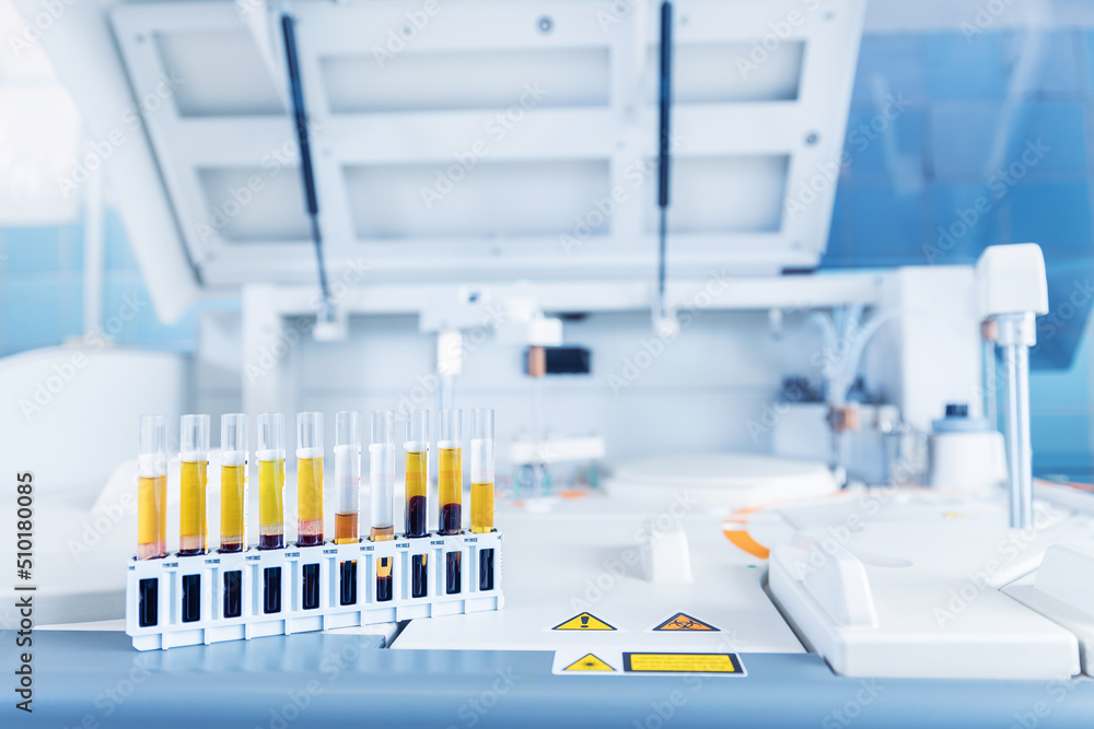 Medical robot machine for biochemical automatic testing blood laboratories Medical robot machine for biochemical automatic testing blood laboratories