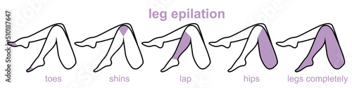 epilation zones of the legs, problems with hair removal. female legs. skin care. illustration in flat style on a white background, patches on the legs to remove hair follicles