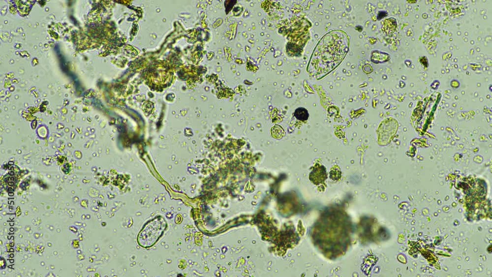 soil microbes organisms in a soil and compost sample, fungus and fungi ...