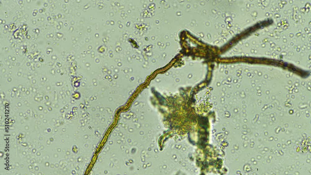 soil microbes organisms in a soil and compost sample, fungus and fungi ...