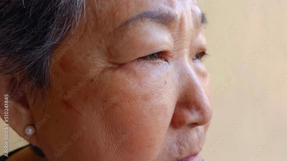 An old woman has wrinkles on her face. An old woman has wrinkles on her face.